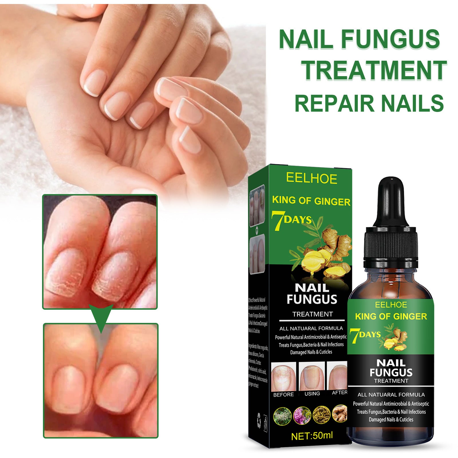 Nail Repair Solution Hand Foot And Nail Care Solution